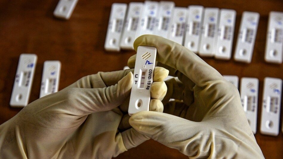 Is Corona returning again? New variants of Covid NB.1.8.1 and LF.7 enter the country, know the latest situation